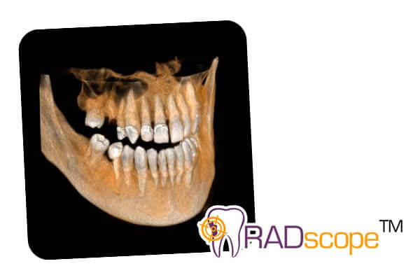 Radscope
